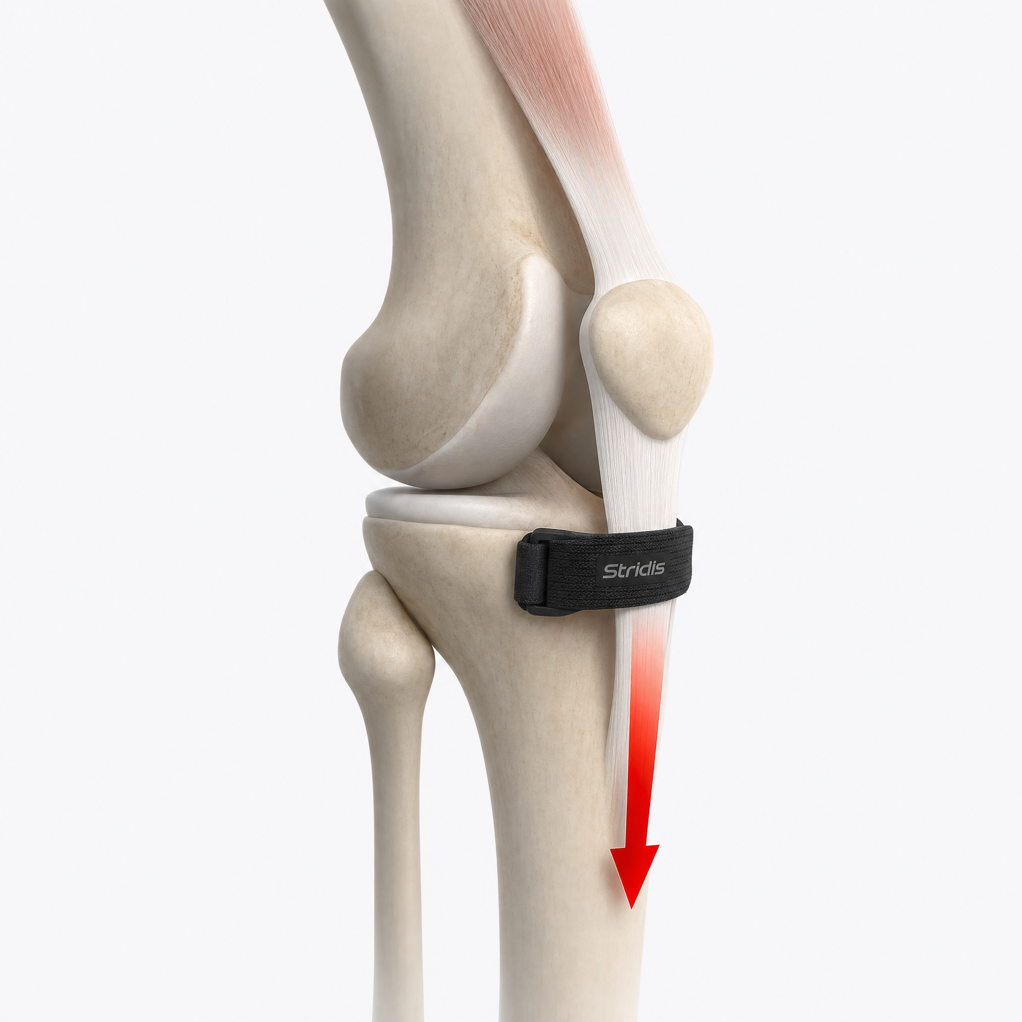 Stridis® |Sangle rotulienne de précision